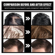 Liquid Biotin & Collagen Hair Growth Drops. - Besafe1st® 