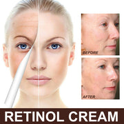 Retinol Anti-Aging Wrinkle Removal Skin Firming Cream. - Besafe1st® 